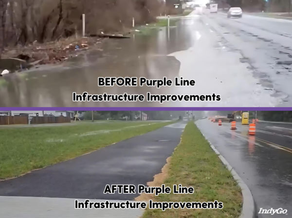 purple line drainage before and after